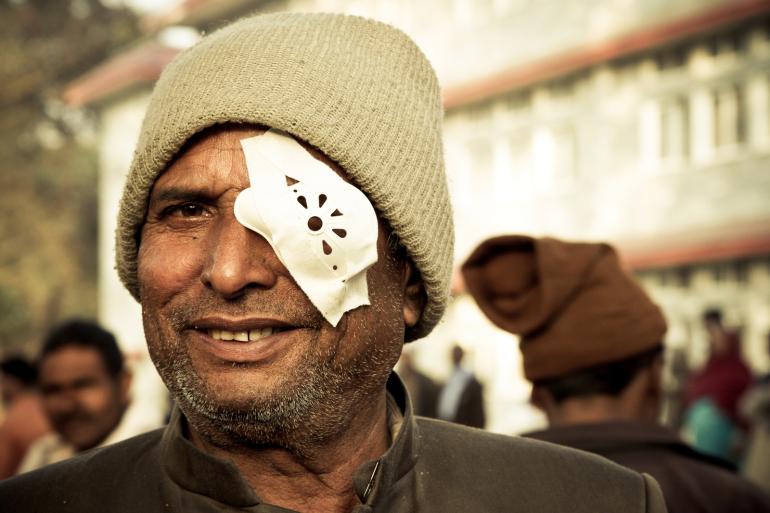 Nepali man after cataract surgery