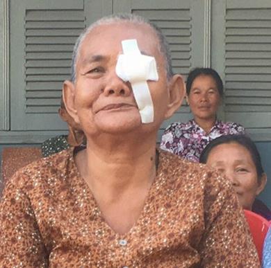 Chong after surgery with bandage over her eye