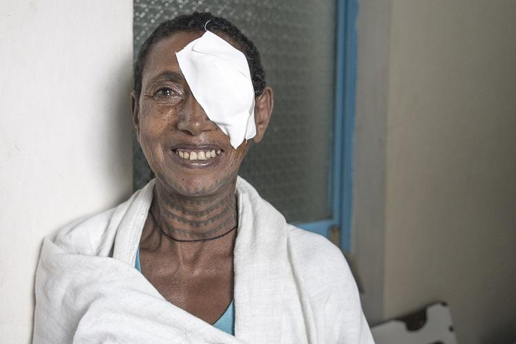 Maguaye in Ethiopia after surgery with an eye patch. Photo by Stephanie C. Glotman