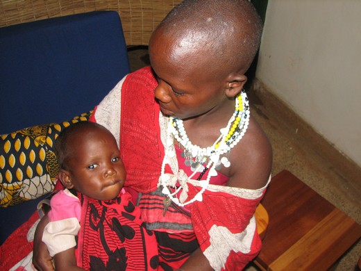 Rose, a 3-year old Masai girl with cataracts before surgery