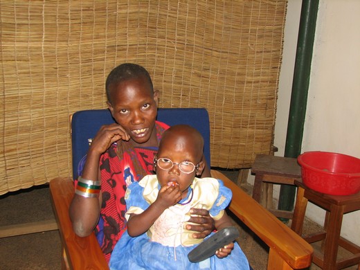 Rose Mollel 3- year old Masai girl after cataract surgery