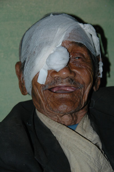 100 year old Nepali patient of Seva's