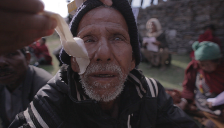 man having bandage removed from right eye and seeing for the first time after cataract surgery