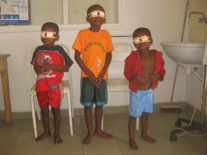3 young boys after cataract surgery with patches over both of their eyes