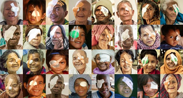 collage of many seva patients smiling with eye patches after cataract surgery