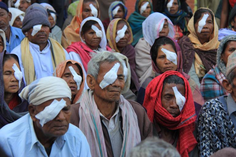 patients after cataract surgery with bandages over their eyes