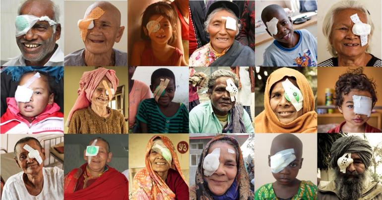 collage of people with eye patches after cataract surgery