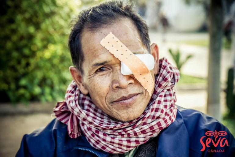 Cambodian man with eye patch by Ellen Crystal