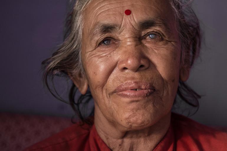 Chamsuri in Nepal with an obvious cataract by Eric Sanderson 