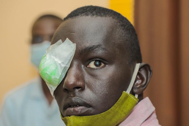 Thierry in Burundi with bandage after one cataract surgery