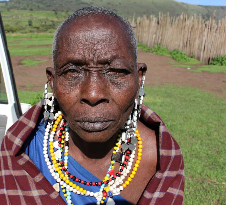 Sepeli Tanzanian woman with trachoma