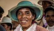Malagasy Woman with Cataract by Ellen Crystal v.2