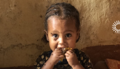 Ethiopian girl with flies in her eyes & NTD symbol