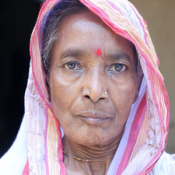 Indian woman - glaucoma 