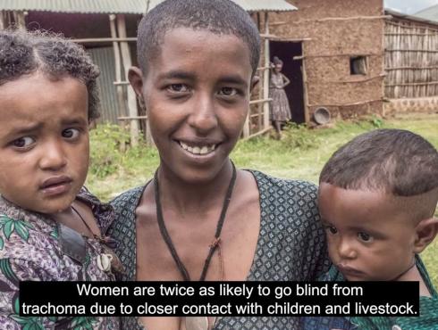 Trachoma - The Leading Infectious Cause of Blindness
