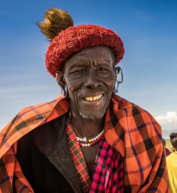 Maasai patient in Tanzania wearing a toque